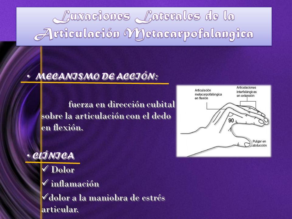 articulacion metacarpofalangica pulgar dolor